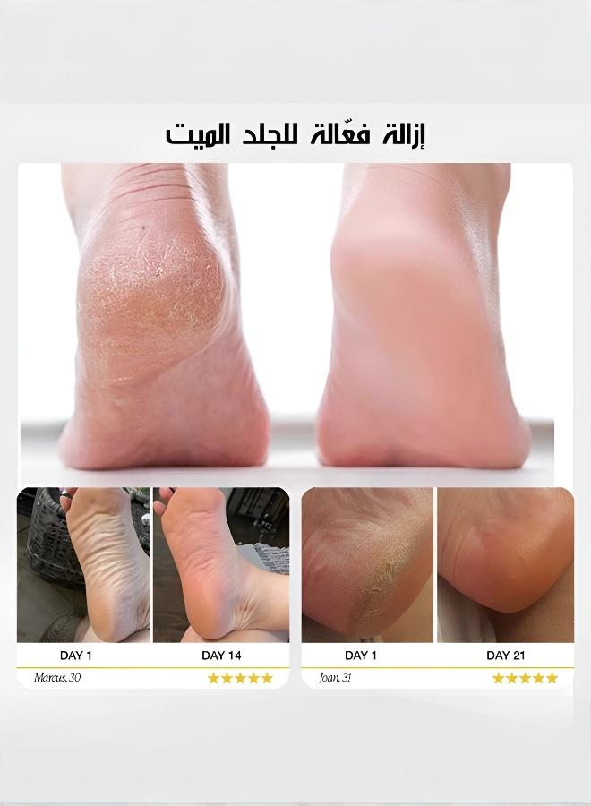 Electric Foot Callus Remover for Smooth Feet - Image 3